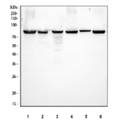 Western blot testing of 1) human K562, 2) human HEL, 3) human Jurkat, 4) rat brain, 5) rat PC-12 and 6) mouse brain tissue lysate with PKC beta antibody. Predicted molecular weight ~76 kDa.
