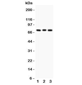 Western blot testing of PKC beta antibody and Lane 1: rat brain; 2: mouse brain; 3: human COLO320. Predicted/observed size ~76KD