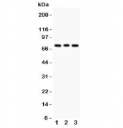 Western blot testing of PKC beta antibody and lysate from 1:  rat brain;  2: mouse brain;  3: human COLO320 cells.  Predicted molecular weight ~76 kDa.