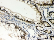 IHC-P: PKC epsilon antibody testing of rat intestine tissue