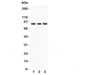 Western blot testing of PKC epsilon antibody and Lane 1:  rat brain;  2: Mosue brain;  3: human MCF-7.  Predicted/observed size ~84KD