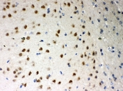 IHC-P: PKC iota antibody testing of mouse brain tissue