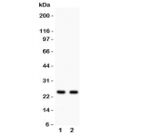 Western blot testing of Rab3A antibody and Lane 1:  rat brain;  2: mouse brain lysate