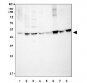 Western blot testing of 1) human A431, 2) human SK-N-SH, 3) human HeLa, 4) rat lung, 5) rat kidney, 6) rat L6, 7) mouse lung and 8) mouse NIH 3T3 cell lysate with HSP47 antibody. Predicted molecular weight ~46 kDa.