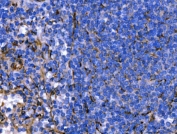 IHC staining of FFPE human spleen tissue with HSP47 antibody. HIER: boil tissue sections in pH8 EDTA for 20 min and allow to cool before testing.