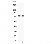 Western blot testing of SHBG antibody and Lane 1:  HeLa;  2: COLO320;  Predicted size per AA content: 44KD, but this highly glycosylated protein is observed up to 100KD
