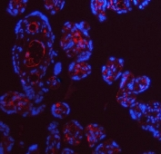 Immunofluorescent staining of FFPE human placental tissue with ApoE antibody (red) and DAPI nuclear stain (blue). HIER: steam section in pH8 EDTA buffer for 20 min.