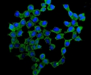 Immunofluorescent staining of FFPE human MCF7 cells with ATP5H antibody (green) and DAPI nuclear stain (blue). HIER: steam section in pH6 citrate buffer for 20 min.
