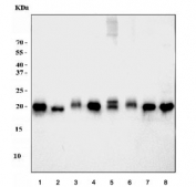 Western blot testing of 1) human HeLa, 2) human HepG2, 3) human U-87 MG, 4) human A549, 5) monkey COS-7, 6) human SW620, 7) human Jurkat and 8) human 293T cell lysate with ATP5H antibody. Expected molecular weight: ~22 kDa.