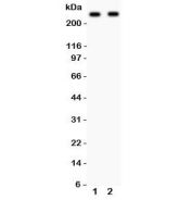 Western blot testing of CaV1.3 antibody and Lane 1:  rat brain;  2: mouse brain lysate.  Predicted molecular weight: ~245 kDa.