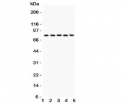 Western blot testing of Calpain antibody and Lane 1:  rat lung;  2: mouse lung;  3: human A549;  4: (h) COLO320;  5: (h) Jurkat. Predicted molecular weight: ~82 kDa.