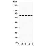Western blot testing of Calpain antibody and Lane 1:  rat lung;  2: mouse lung;  3: human A549;  4: (h) COLO320;  5: (h) Jurkat. Predicted molecular weight: ~82 kDa.