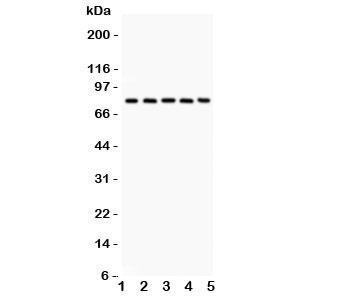 Western blot testing of Calpain antibody and Lane 1: rat lung; 2: mouse lung; 3: human A549; 4: (h) COLO320; 5: (h) Jurkat. Predicted/expected size ~82KD