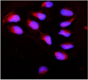 Immunofluorescent staining of FFPE human U-2 OS cells with Calpain antibody (red) and DAPI nuclear stain (blue). HIER: steam section in pH6 citrate buffer for 20 min.
