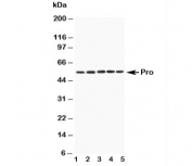 Western blot testing of Caspase-8 antibody and mouse samples:  1. Spleen, 2. Thymus, 3. Kidney, 4. Lung, 5. HEPA1-6 cell lysate. Predicted molecular weight: ~55 kDa (pro), ~40 kDa (large + small subunit), ~11 kDa (small subunit).