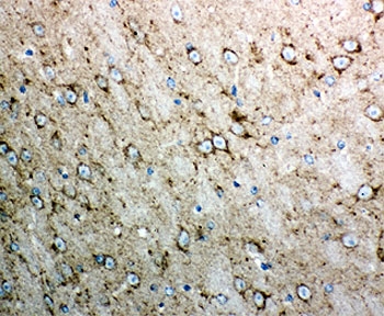 IHC-P testing of mouse brain tissue. HIER: steamed with pH6 citrate buffer.