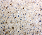 IHC-P testing of rat brain tissue. HIER: steamed with pH6 citrate buffer.