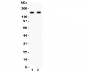 Western blot testing of NR2A antibody and Lane 1:  rat brain;  2: mouse brain lysate.  Predicted/observed size ~165KD