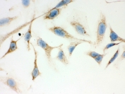 IHC testing of FFPE human HeLa cells with ERAB antibody. HIER: steam section in pH6 citrate buffer for 20 min and allow to cool prior to testing.