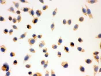 IHC testing of FFPE human SMMC-7721 cells with ERAB antibody. HIER: steam section in pH6 citrate buffer for 20 min and allow to cool prior to testing.
