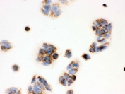 IHC testing of FFPE human MCF7 cells with ERAB antibody. HIER: steam section in pH6 citrate buffer for 20 min and allow to cool prior to testing.