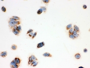IHC testing of FFPE human MCF7 cells with ERAB antibody. HIER: steam section in pH6 citrate buffer for 20 min and allow to cool prior to testing.