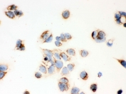 IHC testing of FFPE human MCF7 cells with ERAB antibody. HIER: steam section in pH6 citrate buffer for 20 min and allow to cool prior to testing.