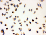 IHC testing of FFPE human SMMC-7721 cells with ERAB antibody. HIER: steam section in pH6 citrate buffer for 20 min and allow to cool prior to testing.