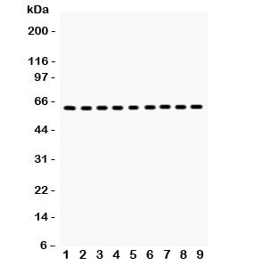 Western blot testing of HSP60 antibody and Lane 1: rat kidney; 2: mouse kidney; 3: (m) HEPA; 4: (r) NRK; 5: (r) PC12; 6: human SW620; 7: (h) A549; 8: (h) A431; 9: (h) HeLa lysate. Predicted/observed size ~60KD