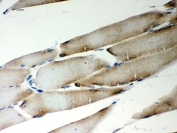 IHC-P: LYRIC antibody testing of rat skeletal muscle tissue. HIER: steam section in pH6 citrate buffer for 20 min and allow to cool prior to testing.