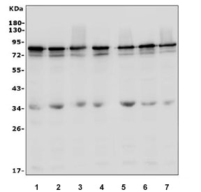Western blot testing of human 1) U-87 MG, 2) HeLa, 3) MDA-MB-453, 4) PC-3, 5) A431, 6) Caco-2 and 7) HepG2 cell lysate with LYRIC antibody. Expected molecular weight: 70-80 kDa.
