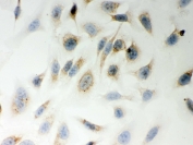 ICC testing of FFPE human HeLa cells with LYRIC antibody. HIER: steam section in pH6 citrate buffer for 20 min and allow to cool prior to testing.