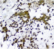 IHC staining of FFPE human placenta with NMI antibody. HIER: boil tissue sections in pH8 EDTA for 20 min and allow to cool before testing.