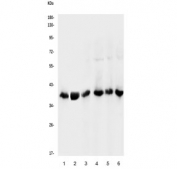 Western blot testing of human 1) placenta, 2) K562, 3) Caco-2, 4) A431, 5) PC-3 and 6) 293T lysate with NMI antibody. Predicted molecular weight ~35 kDa.