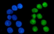 Immunofluorescent staining of FFPE human Caco-2 cells with Nucleophosmin antibody (green) and DAPI nuclear stain (blue). HIER: steam section in pH6 citrate buffer for 20 min.