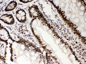 IHC staining of FFPE rat intestinal tissue with Nucleophosmin antibody. HIER: boil tissue sections in pH8 EDTA for 20 min and allow to cool before testing.