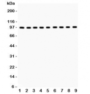 Western blot testing of GR antibody and Lane 1:  rat liver;  2: (r) brain;  3: (r) spleen;  4: human placenta;  5: (h) SMMC;  6: mouse HEPA;  7: (m) Neuro-2a;  8: (h) HeLa;  9: (r) PC12;  Predicted/Observed size: 91~94KD