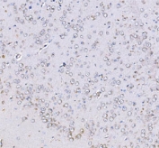 IHC staining of FFPE rat brain tissue with Optineurin antibody. HIER: boil tissue sections in pH8 EDTA for 20 min and allow to cool before testing.  