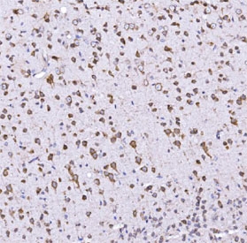 IHC staining of FFPE mouse brain tissue with Optineurin antibody. HIER: boil tissue sections in pH8 EDTA for 20 min and allow to cool before testing.