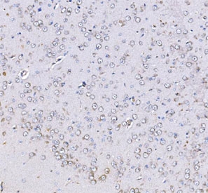 IHC staining of FFPE rat brain tissue with Optineurin antibody. HIER: boil tissue sections in pH8 EDTA for 20 min and allow to cool before testing.