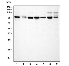 Western blot testing of 1) human HeLa, 2) human HT1080, 3) human HepG2, 4) rat heart, 5) rat brain, 6) mouse heart and 7) mouse brain tissue lysate with Optineurin antibody. Expected molecular weight: 66-74 kDa depending on phosphorylation level.