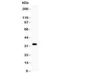 Western blot testing of Otx2 antibody and COLO320 lysate.  Predicted/observed size ~32KD