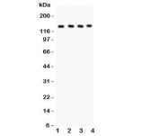 Western blot testing of PLCB1 antibody and Lane 1:  rat brain;  2: mouse brain;  3: mouse testis;  4: human placenta lysate