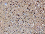 IHC staining of FFPE rat brain tissue with PP2A antibody. HIER: boil tissue sections in pH8 EDTA for 20 min and allow to cool before testing.