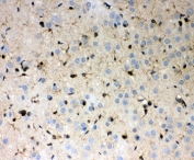 IHC-P testing of rat brain tissue. HIER: steamed with pH6 citrate buffer.