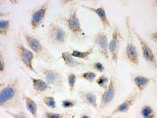 ICC testing of FFPE human HeLa cells with PRDX3 antibody. HIER: steam section in pH6 citrate buffer for 20 min and allow to cool prior to testing.