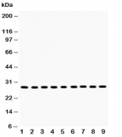 Western blot testing of PRDX3 antibody and Lane 1:  rat brain;  2: mouse brain;  3: rat skeletal muscle;  4: mouse skeletal muscle;  5: human U-2 0S;  6: HeLa;  7: SMMC-7721;  8: RH35;  9: A549 lysate.  Expected molecular weight: ~28 kDa.