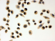 ICC testing of FFPE human SMMC-7721 cells with PRDX3 antibody. HIER: steam section in pH6 citrate buffer for 20 min and allow to cool prior to testing.