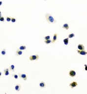Immunocytochemical staining of FFPE human PC-3 cells with Peroxiredoxin 6 antibody. HIER: boil tissue sections in pH6, 10mM citrate buffer, for 20 min and allow to cool before testing.
