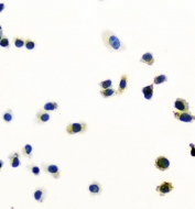 Immunocytochemical staining of FFPE human PC-3 cells with Peroxiredoxin 6 antibody. HIER: boil tissue sections in pH6, 10mM citrate buffer, for 20 min and allow to cool before testing.